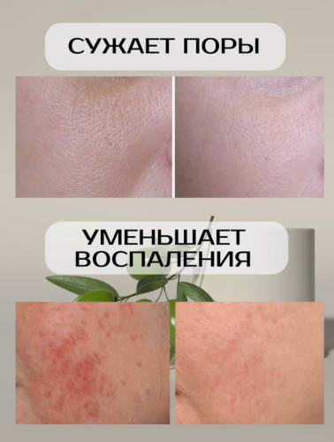 Антивозрастная сыворотка с маслом оливы Zozu Olive Oil Antioxidant 30мл фото 3
